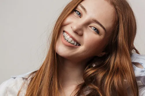 Kieferorthopädie Luzern - Zahnspange